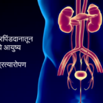 Kidney Transplant at Sassoon Hospital