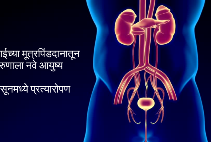 Kidney Transplant at Sassoon Hospital